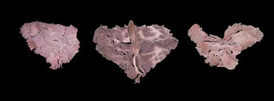 Particles-Patricia Ludovici: The Disappointments
